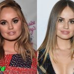 Debby Ryan Before and After Plastic Surgery