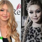 Gigi Hadid Before and After Cosmetic Surgery 150x150