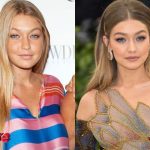 Gigi Hadid Before and After Plastic Surgery 150x150