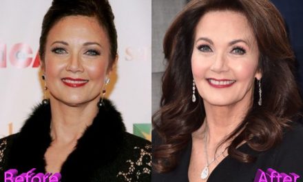 Lynda Carter Plastic Surgery: Just Keep Getting Younger