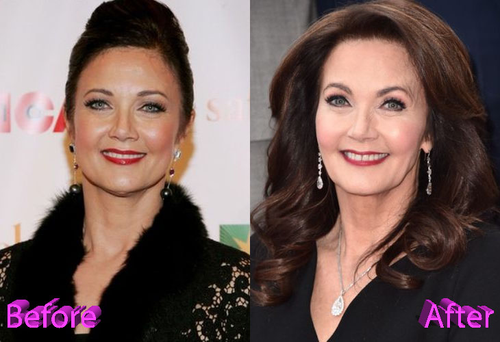 Lynda Carter Plastic Surgery: Just Keep Getting Younger