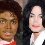 Michael Jackson before and after plastic surgery