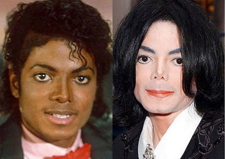 Michael Jackson before and after plastic surgery