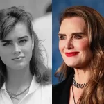 Brooke Shields Before and After Plastic Surgery