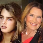 Brooke Shields before and after