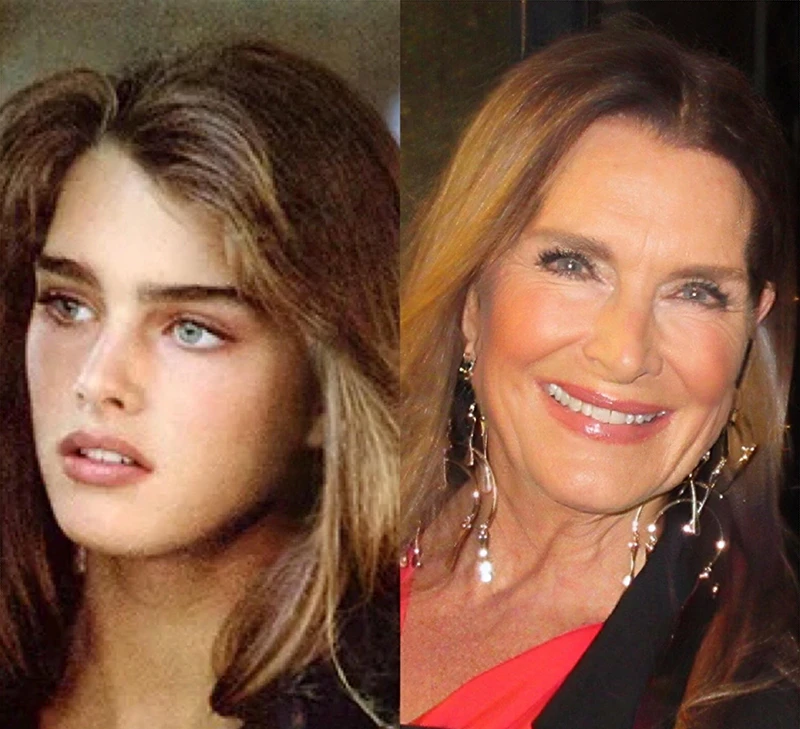 Brooke Shields before and after