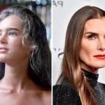 Brooke Shields plastic surgery