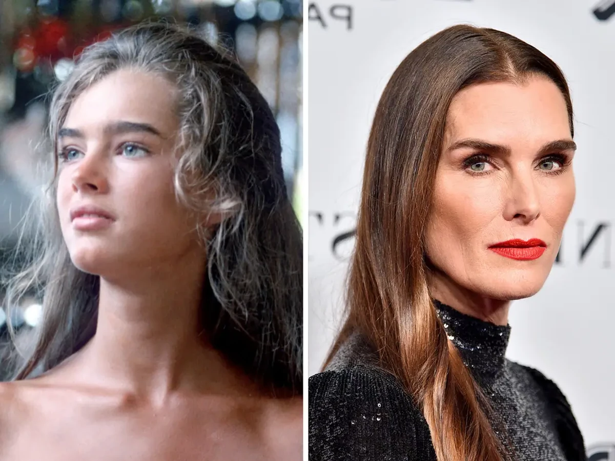 Brooke Shields plastic surgery