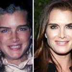 Brooke Shields transformation