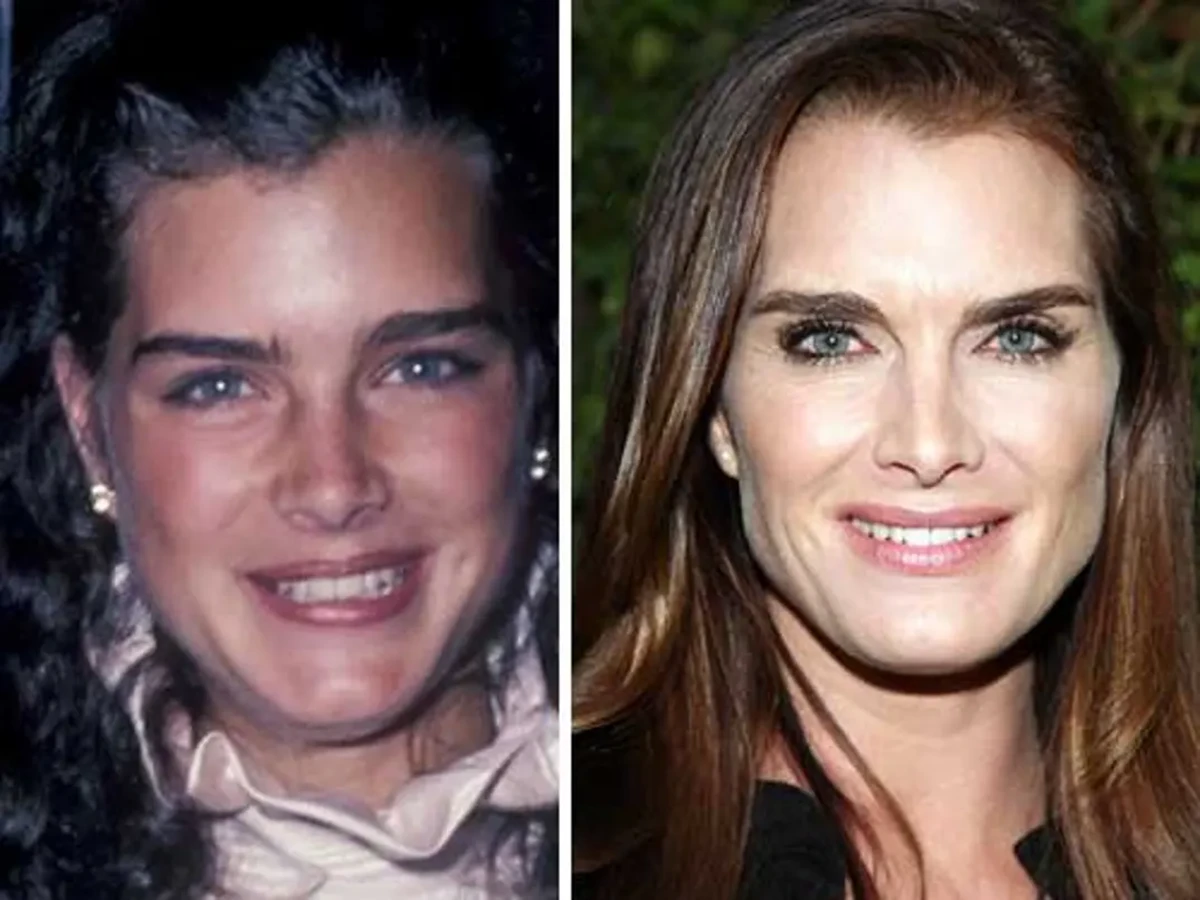 Brooke Shields transformation