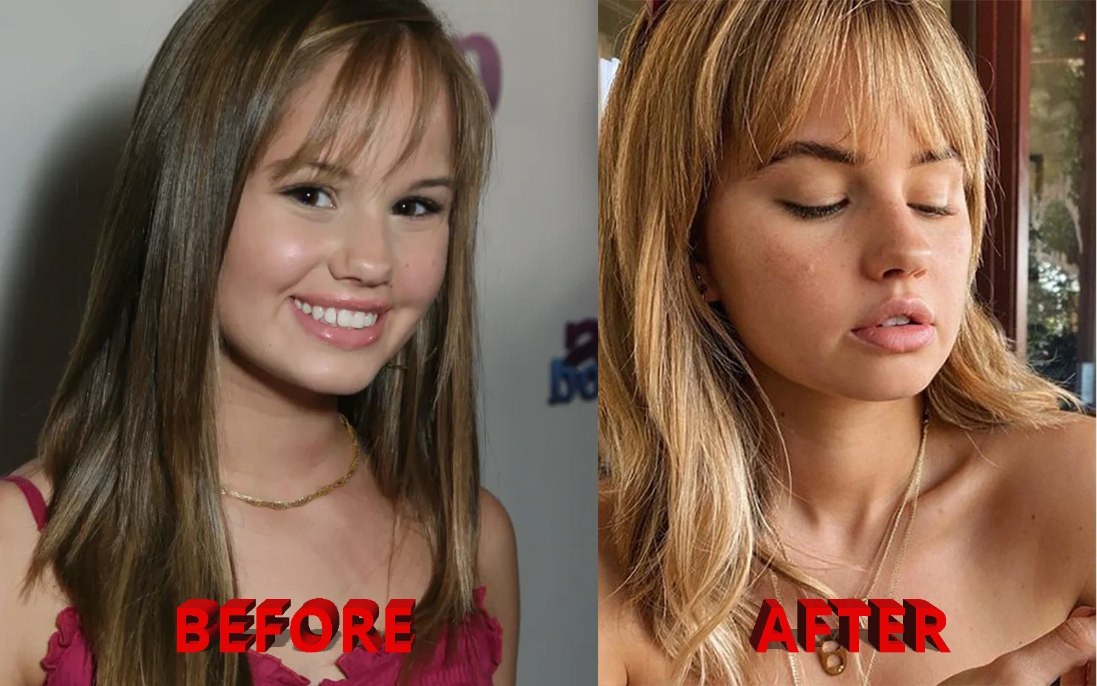 Debby Ryan Before and After Lip Fillers