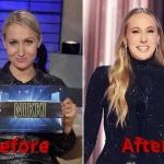 Nikki Glaser Before and After