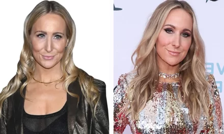 Nikki Glaser’s Plastic Surgery Rumors