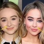 Sabrina Carpenter Plastic Surgery