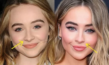 Sabrina Carpenter Nose Job Plastic Surgery Rumors Explained: Secret to Perfection!