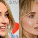 Sabrina Carpenter before and after