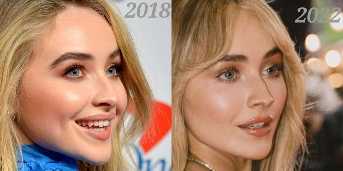 Sabrina Carpenter before and after