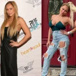 Darcey and Stacey Silva before and after plastic surgery