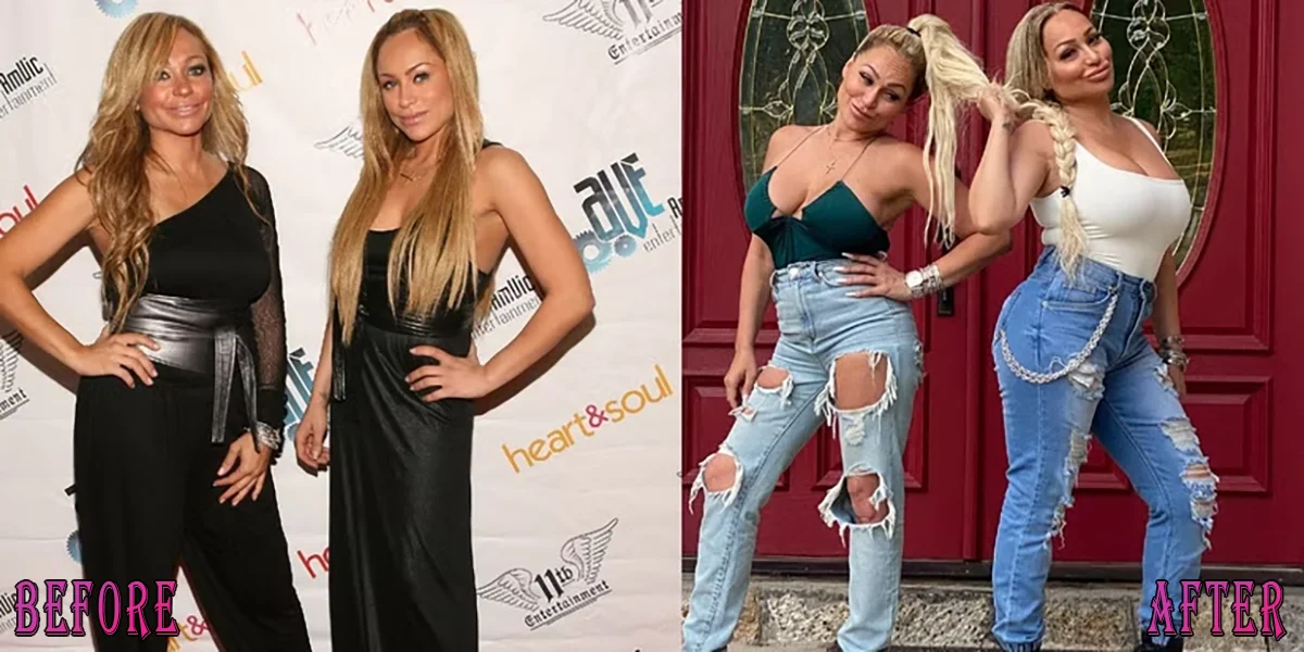 Darcey and Stacey Silva before and after plastic surgery