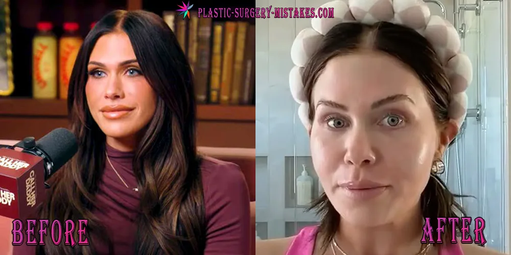 Jessi Draper Plastic Surgery: Inside Her Transformation 🔍