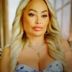 Stacey Silva plastic surgery