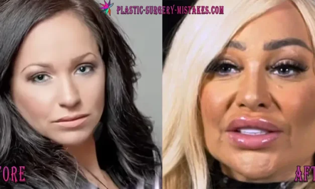 Inside Stacey Silva Plastic Surgery Timeline: Rhinoplasty, Facelifts, and Her New Face 😱