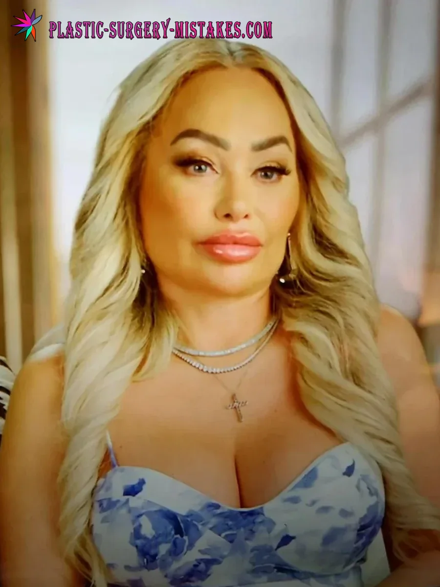 Stacey Silva plastic surgery