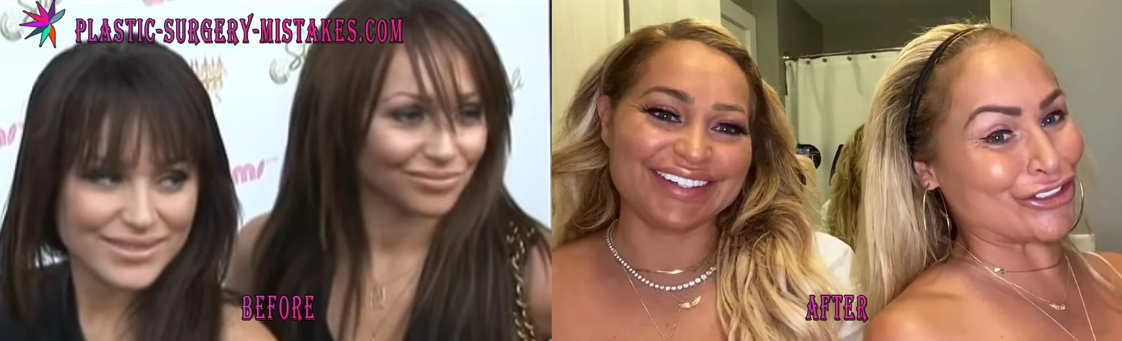 Stacey and Darcey Silva before and after plastic surgery