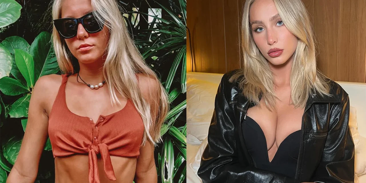 Alix Earle Plastic Surgery: Confessions, Regrets, & BBL Rumors Revealed! π