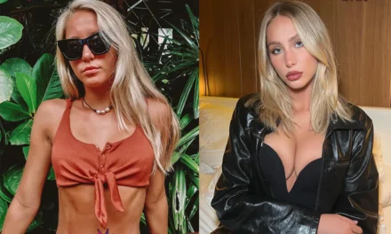 Alix Earle Plastic Surgery: Confessions, Regrets, & BBL Rumors Revealed! 🍑
