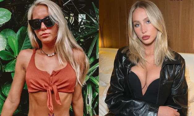 Alix Earle Plastic Surgery: Confessions, Regrets, & BBL Rumors Revealed! 🍑