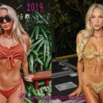 Alix Earle Before and After Plastic Surgery