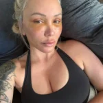 Bunnie XO After Facelift Plastic Surgery 150x150