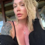 Bunnie XO with a significant sunburn 150x150