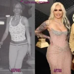 Bunnie Xo Before and After Plastic Surgery 150x150