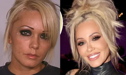 The Truth About Bunnie XO Plastic Surgery: Explants, Rumors, and Total Honesty