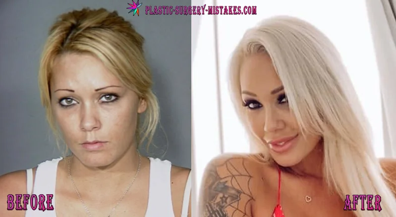 Bunnie Xo Plastic Surgery Before and After