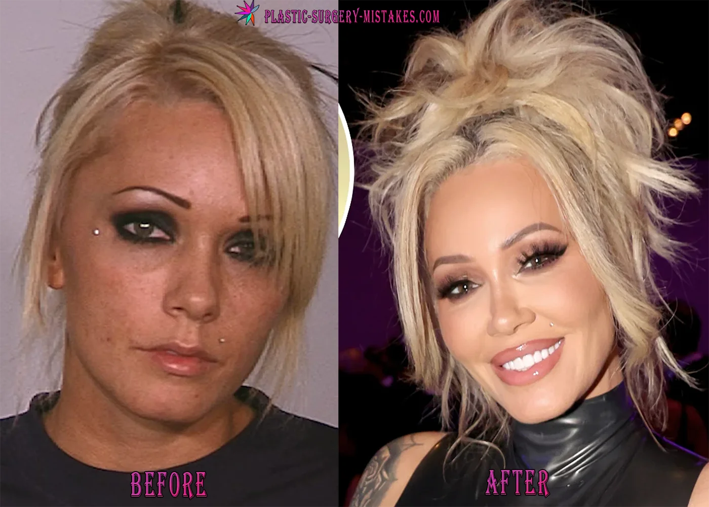 Bunnie Xo Plastic Surgery