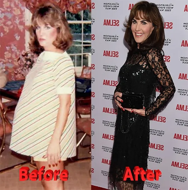 Dr Phil's Wife Robin McGraw Robin McGraw Before and After Plastic Surgery