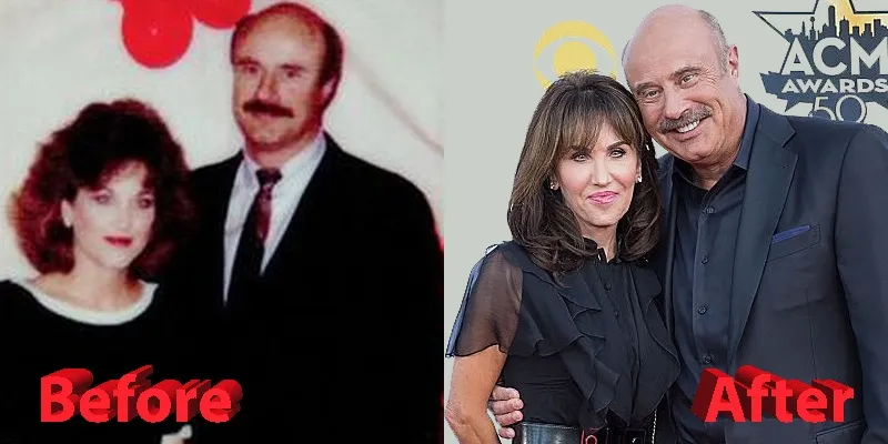 Dr. Phil and Robin McGraw Before and After Robin McGraw Before and After Plastic Surgery