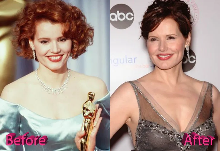 Geena-Davis-Before-and-After-Cosmetic-Surgery Geena Davis Before And After Cosmetic Surgery