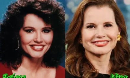 Geena Davis Plastic Surgery: Did Thelma Get a Little Too Much Work in 2026? 💉