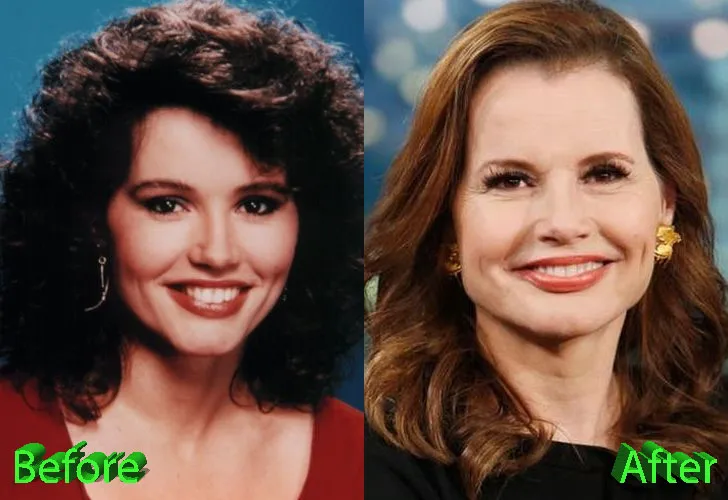 Geena Davis Plastic Surgery: Did Thelma Get a Little Too Much Work in 2026? ๐