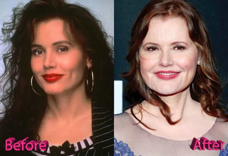 Geena-Davis-Plastic-Surgery-Before-and-After Geena Davis Plastic Surgery Before And After