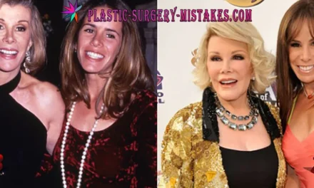 💉 Joan Rivers Plastic Surgery: The Wild Confessions, Iconic Procedures & Overdone Look Revealed 👑