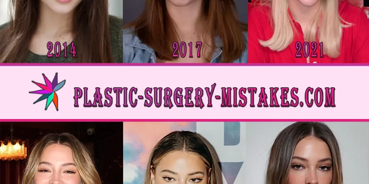 Madelyn Cline Plastic Surgery & Before/After Secrets Exposed 💋✨