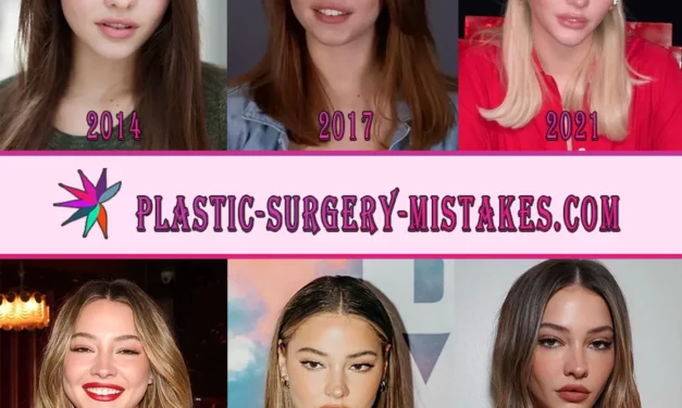 Madelyn Cline Plastic Surgery & Before/After Secrets Exposed 💋✨