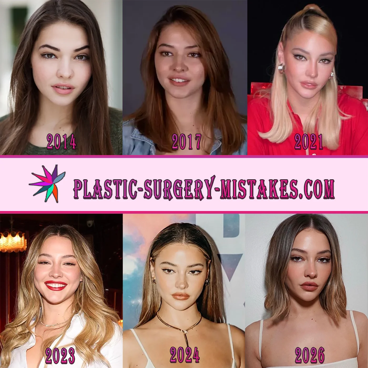Madelyn Cline Before And After Comparison