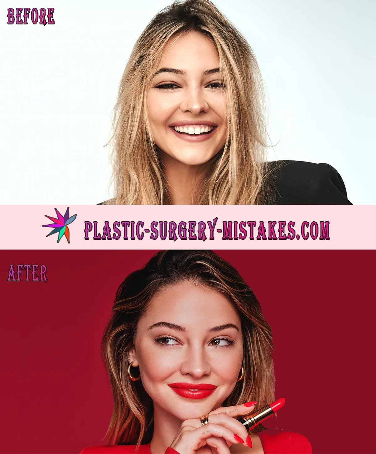 Madelyn Cline Plastic Surgery Before And After