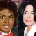 Michael Jackson Before and After Plastic Surgery